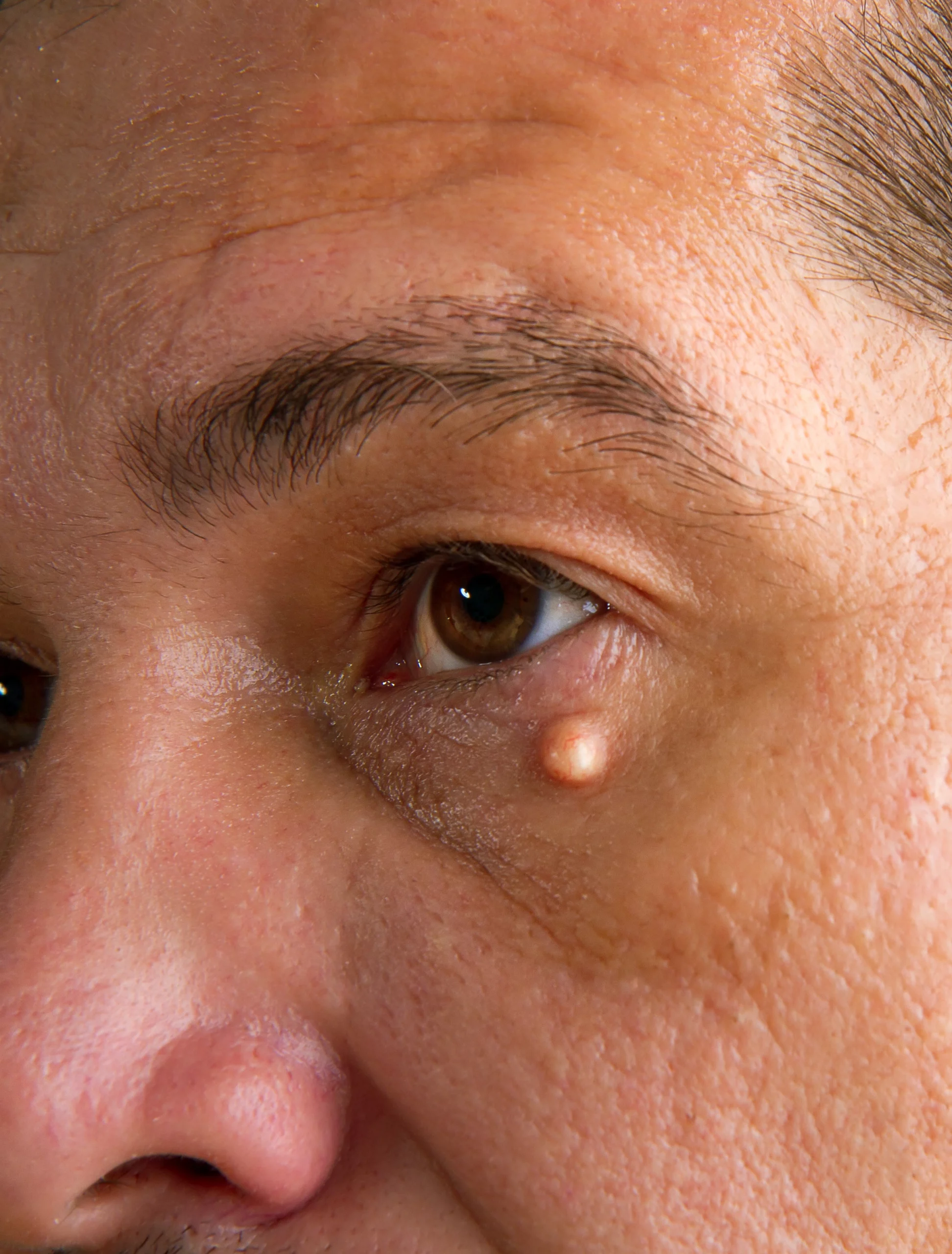 Pediatrie-Votre ophtalmologue à St-Maur-des-Fossés & Draveil